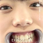 Thumbnail of related posts 156